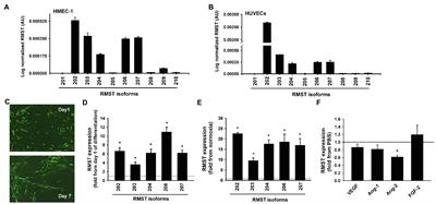 Long Non-coding RNA Rhabdomyosarcoma 2-Associated Transcript Regulates Angiogenesis in Endothelial Cells